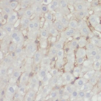 SCD Rabbit Polyclonal Antibody