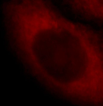 SCIN Rabbit Polyclonal Antibody