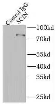 SCIN Rabbit Polyclonal Antibody