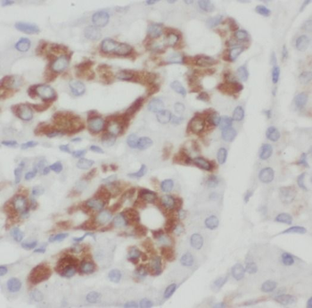 SCIN Rabbit Polyclonal Antibody