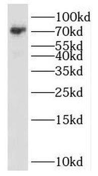 SCML2 Rabbit Polyclonal Antibody