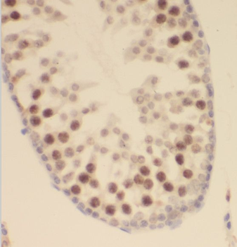 SCML2 Rabbit Polyclonal Antibody