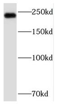 SCN9A Rabbit Polyclonal Antibody