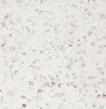SCN9A Rabbit Polyclonal Antibody