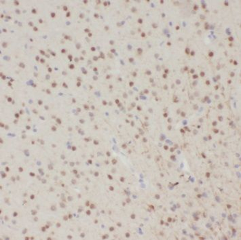 SCNM1 Rabbit Polyclonal Antibody