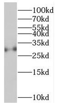SYCP3 Rabbit Polyclonal Antibody
