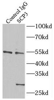 SYCP3 Rabbit Polyclonal Antibody