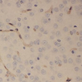 SCRG1 Rabbit Polyclonal Antibody