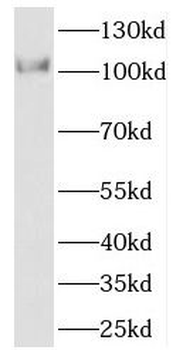 SCYL2 Rabbit Polyclonal Antibody