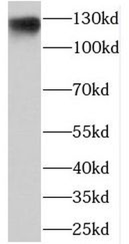 NEMF Rabbit Polyclonal Antibody