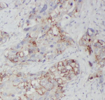 NEMF Rabbit Polyclonal Antibody
