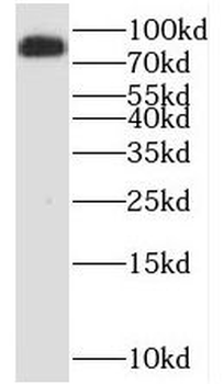 SDCCAG8 Rabbit Polyclonal Antibody
