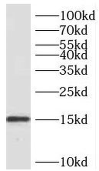 SDHC Rabbit Polyclonal Antibody
