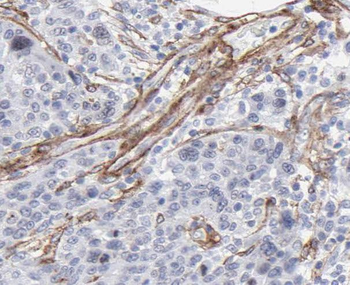 SDHC Rabbit Polyclonal Antibody