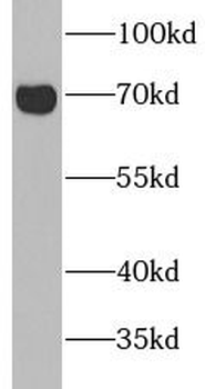 CAVIN2 Rabbit Polyclonal Antibody