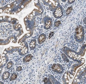 SDR42E1 Rabbit Polyclonal Antibody