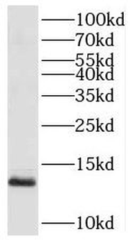SEC61B Rabbit Polyclonal Antibody