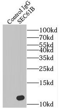 SEC61B Rabbit Polyclonal Antibody