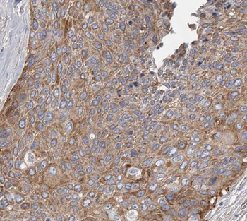 SEC61B Rabbit Polyclonal Antibody