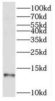 SEC61B Rabbit Polyclonal Antibody