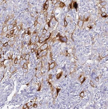 SEC61B Rabbit Polyclonal Antibody