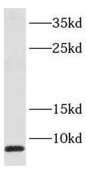 SEC61G Rabbit Polyclonal Antibody