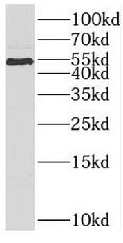 SCTR Rabbit Polyclonal Antibody