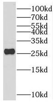SCG5 Rabbit Polyclonal Antibody