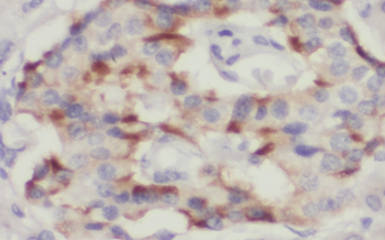 SCG5 Rabbit Polyclonal Antibody