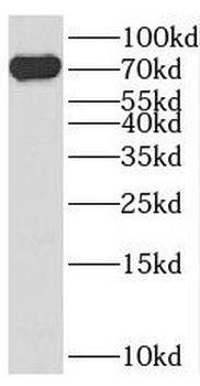SEMA3C Rabbit Polyclonal Antibody