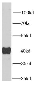 SEPHS1 Rabbit Polyclonal Antibody