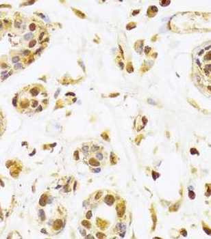 SEPHS1 Rabbit Polyclonal Antibody