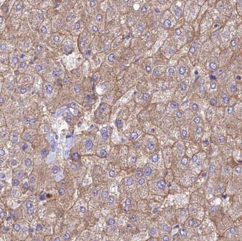 SERINC1 Rabbit Polyclonal Antibody