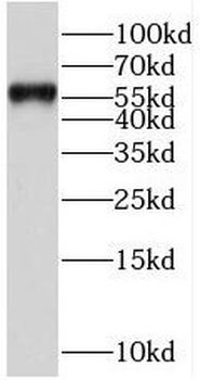 SERPIND1 Rabbit Polyclonal Antibody