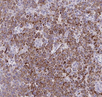 SERPIND1 Rabbit Polyclonal Antibody