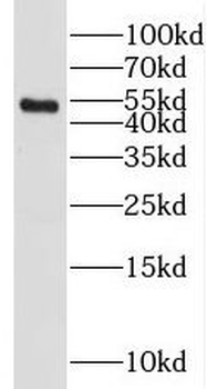 SETD7 Antibody