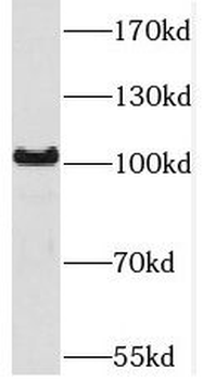 SETDB2 Antibody
