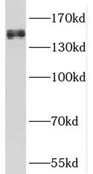 SFI1 Rabbit Polyclonal Antibody