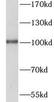 SFMBT2 Rabbit Polyclonal Antibody