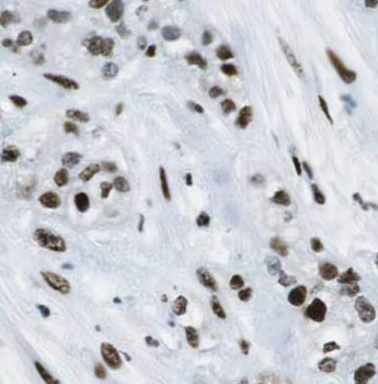 AKAP17A Rabbit Polyclonal Antibody
