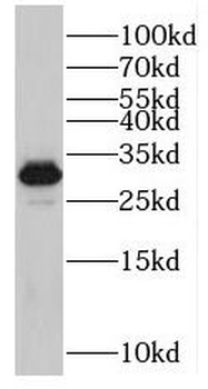 SRSF2 Rabbit Polyclonal Antibody