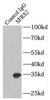 SRSF2 Rabbit Polyclonal Antibody
