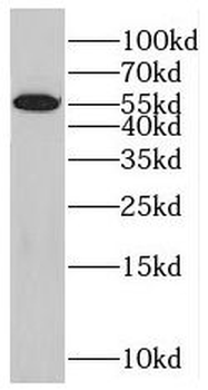 SRSF6 Rabbit Polyclonal Antibody
