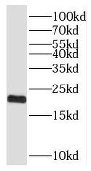 SFT2D3 Rabbit Polyclonal Antibody