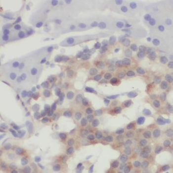 SFT2D3 Rabbit Polyclonal Antibody