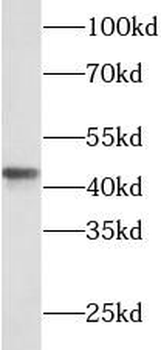 SFTPB Rabbit Polyclonal Antibody