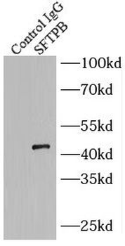 SFTPB Rabbit Polyclonal Antibody