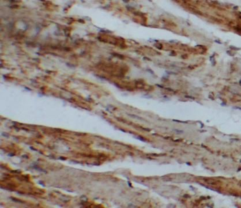 SFTPB Rabbit Polyclonal Antibody