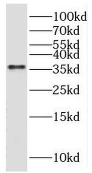 SGCG Rabbit Polyclonal Antibody