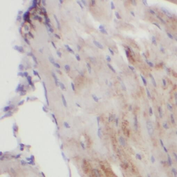 SGCG Rabbit Polyclonal Antibody